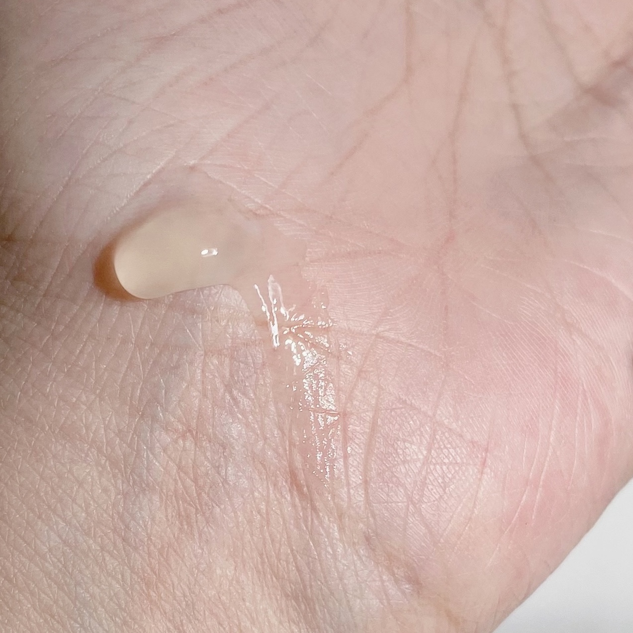 MEDERMA ADVANCED GEL